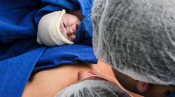 Napoli, il miracolo di Sara: dà alla luce la sua bambina nonostante un cuore malato