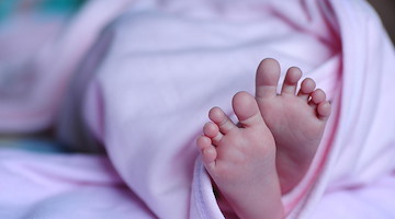 Neonata salvata al Meyer di Firenze: era arrivata da Gaza con un tumore di 2 chili