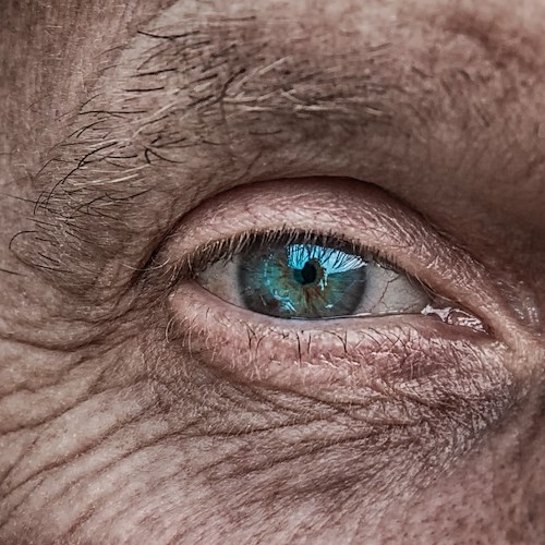 Sanità italiana, in aumento malattie degli occhi